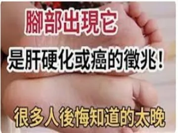 肝不好,腳先知!早點這樣做,讓你輕鬆控制肝病,遠離肝硬化,肝癌危機!