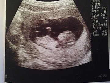 50 グレア エコー 可愛い 最高のアニメギャラリー