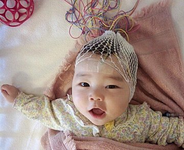 医師監修 骨 関節の病気 1歳 幼児 子どもがかかりやすい病気の話 たまひよ