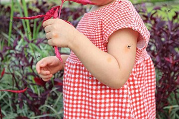 赤ちゃん 子どもが虫に刺されちゃったら どうケアする 受診の目安は 専門医 たまひよ