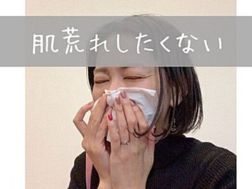 年中鼻炎の肌荒れ対策！三種の神器を教えます