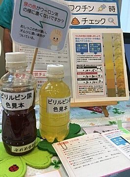 医師監修 生後3ヶ月まで要チェック 胆道閉鎖症 と 便色カード の上手な使い方 たまひよ