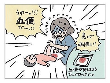 突然の血便 子どもが腸重積症を経験したママの体験談 たまひよ