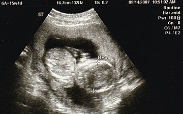 妊娠34週 赤ちゃんのエコー写真 超音波写真まとめ たまひよ 妊娠34週 赤ちゃんのエコー写真 超音波写真まとめ たまひよ