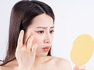 涙袋ぷっくり…実は老けのサインかも!?ツボ押し&ストレッチで予防ケア
