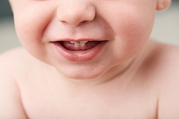 妊娠中の歯周病で早産のリスクが増すって本当 たまひよ